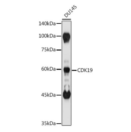 Western Blot - Anti-CDC2L6 Antibody (A90570) - Antibodies.com