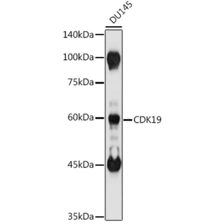 Western Blot - Anti-CDC2L6 Antibody (A90570) - Antibodies.com