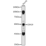 Western Blot - Anti-CDC2L6 Antibody (A90570) - Antibodies.com