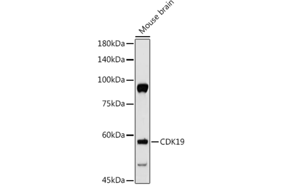 Western Blot - Anti-CDC2L6 Antibody (A90570) - Antibodies.com