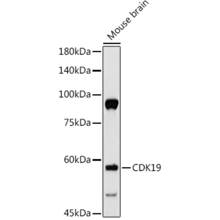 Western Blot - Anti-CDC2L6 Antibody (A90570) - Antibodies.com