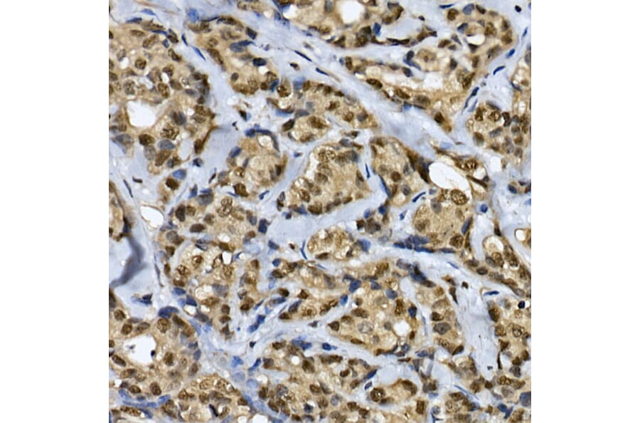 Immunohistochemistry - Anti-CDC2L6 Antibody (A90570) - Antibodies.com