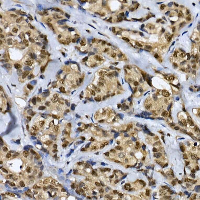 Immunohistochemistry - Anti-CDC2L6 Antibody (A90570) - Antibodies.com