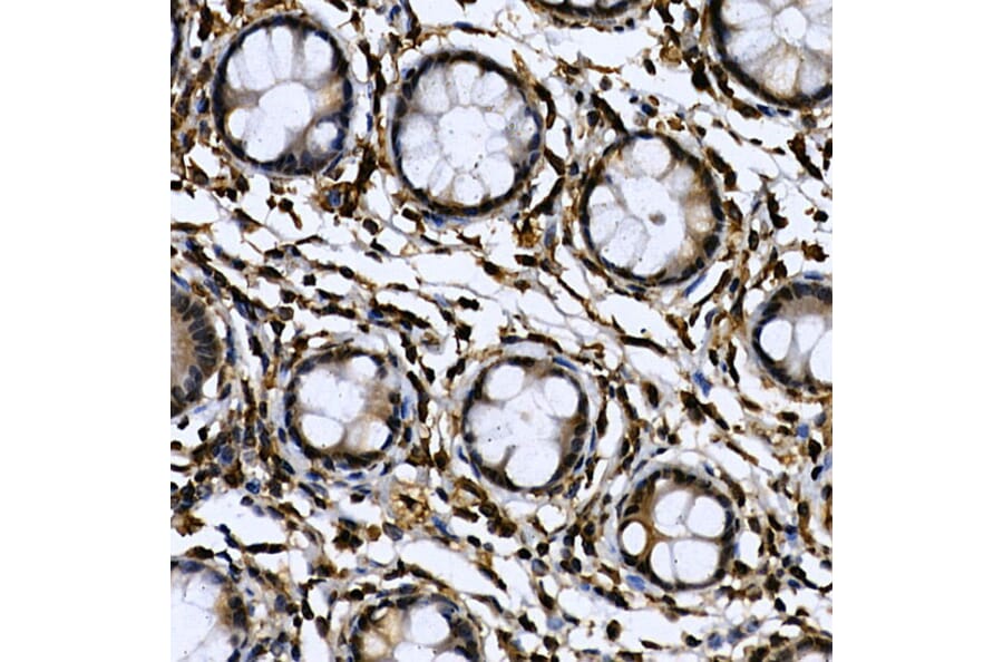 Immunohistochemistry - Anti-CDC2L6 Antibody (A90570) - Antibodies.com