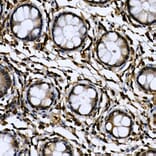 Immunohistochemistry - Anti-CDC2L6 Antibody (A90570) - Antibodies.com