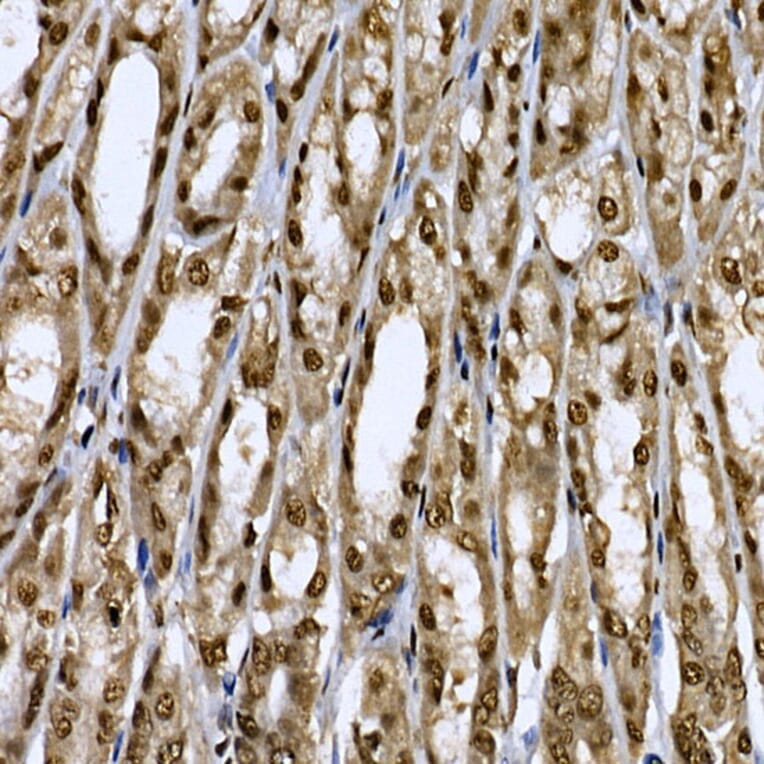 Immunohistochemistry - Anti-CDC2L6 Antibody (A90570) - Antibodies.com