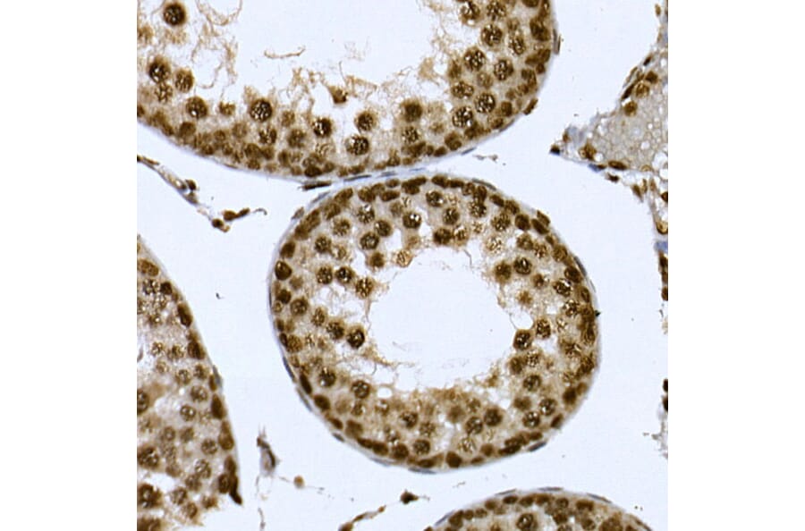 Immunohistochemistry - Anti-CDC2L6 Antibody (A90570) - Antibodies.com