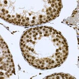 Immunohistochemistry - Anti-CDC2L6 Antibody (A90570) - Antibodies.com
