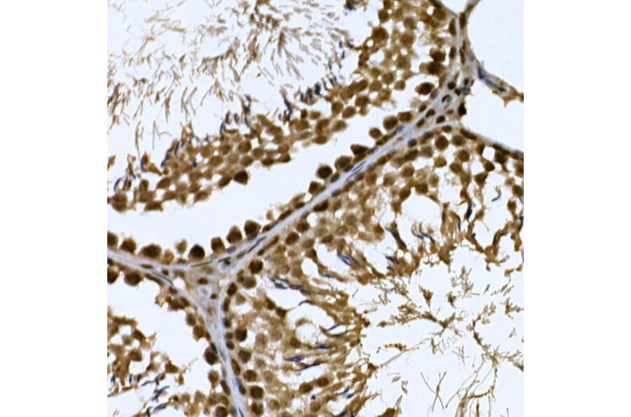 Immunohistochemistry - Anti-CDC2L6 Antibody (A90570) - Antibodies.com