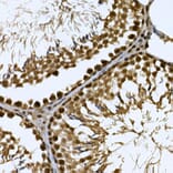 Immunohistochemistry - Anti-CDC2L6 Antibody (A90570) - Antibodies.com