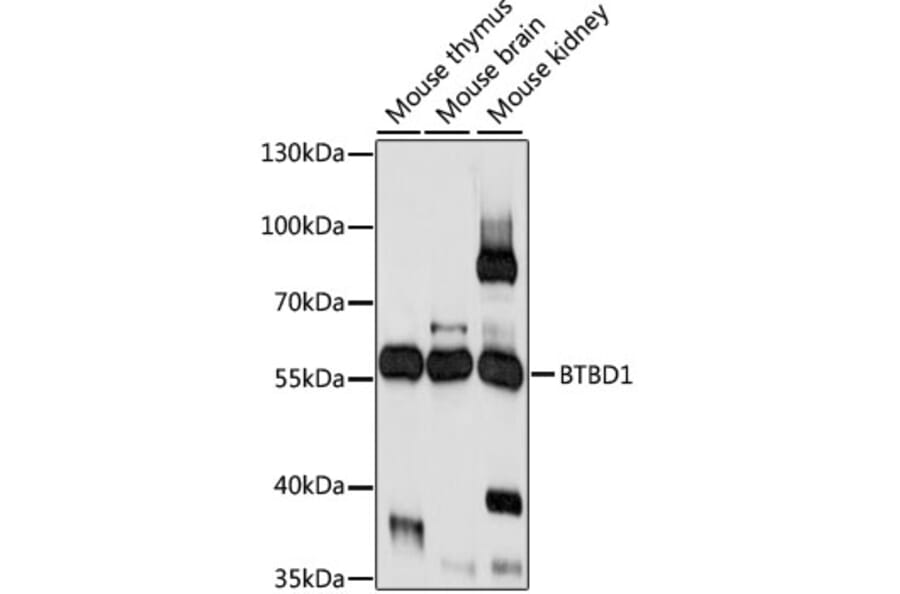 Western Blot - Anti-BTBD1 Antibody (A90571) - Antibodies.com