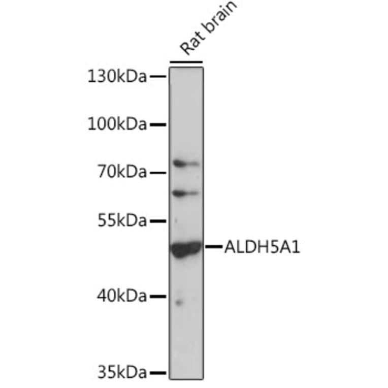Western Blot - Anti-ALDH5A1/SSADH Antibody (A90572) - Antibodies.com