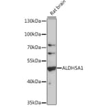 Western Blot - Anti-ALDH5A1/SSADH Antibody (A90572) - Antibodies.com