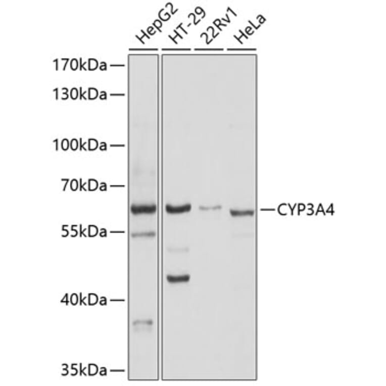 Western Blot - Anti-CYP3A4 Antibody (A14224) - Antibodies.com