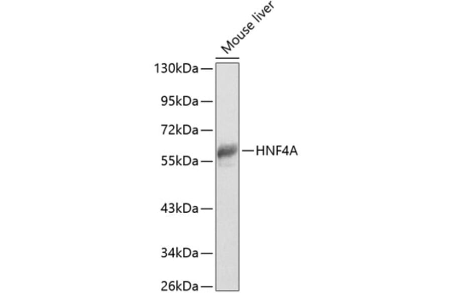 Western Blot - Anti-HNF-4-alpha Antibody (A90574) - Antibodies.com