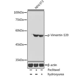 Western Blot - Anti-Vimentin (phospho Ser39) Antibody (A90575) - Antibodies.com
