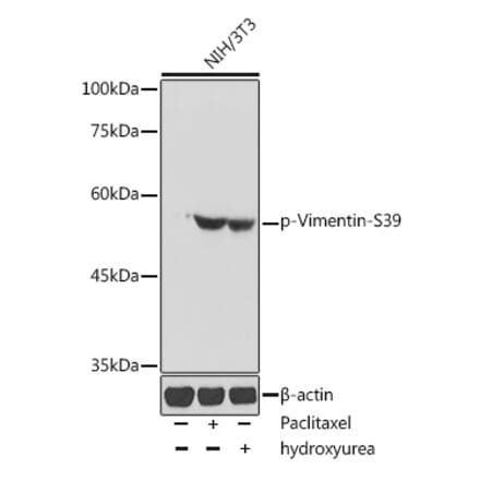Western Blot - Anti-Vimentin (phospho Ser39) Antibody (A90575) - Antibodies.com