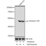 Western Blot - Anti-Vimentin (phospho Ser39) Antibody (A90575) - Antibodies.com