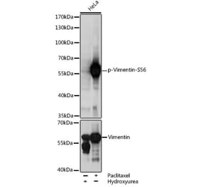 Western Blot - Anti-Vimentin (phospho Ser56) Antibody (A90576) - Antibodies.com