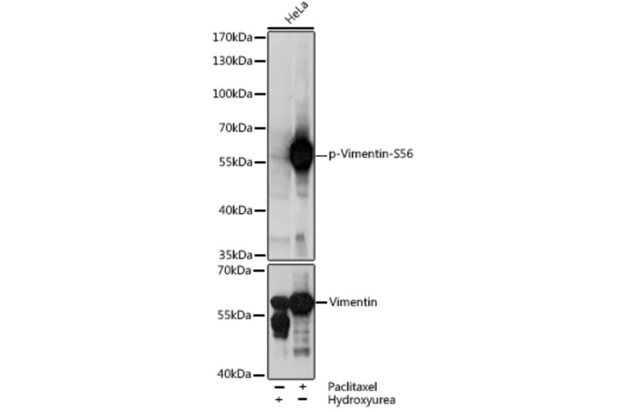 Western Blot - Anti-Vimentin (phospho Ser56) Antibody (A90576) - Antibodies.com