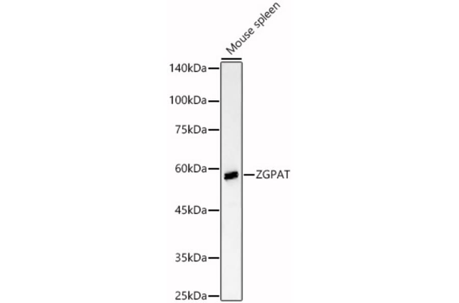Western Blot - Anti-ZGPAT Antibody (A90577) - Antibodies.com