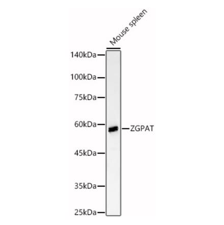 Western Blot - Anti-ZGPAT Antibody (A90577) - Antibodies.com