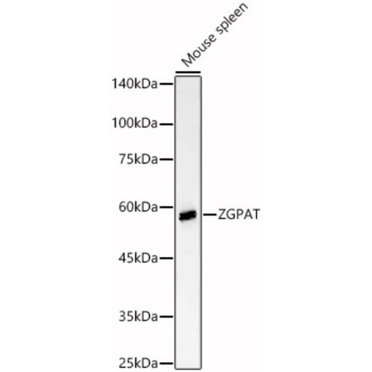 Western Blot - Anti-ZGPAT Antibody (A90577) - Antibodies.com