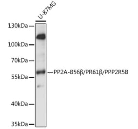 Western Blot - Anti-PPP2R5B Antibody (A90578) - Antibodies.com