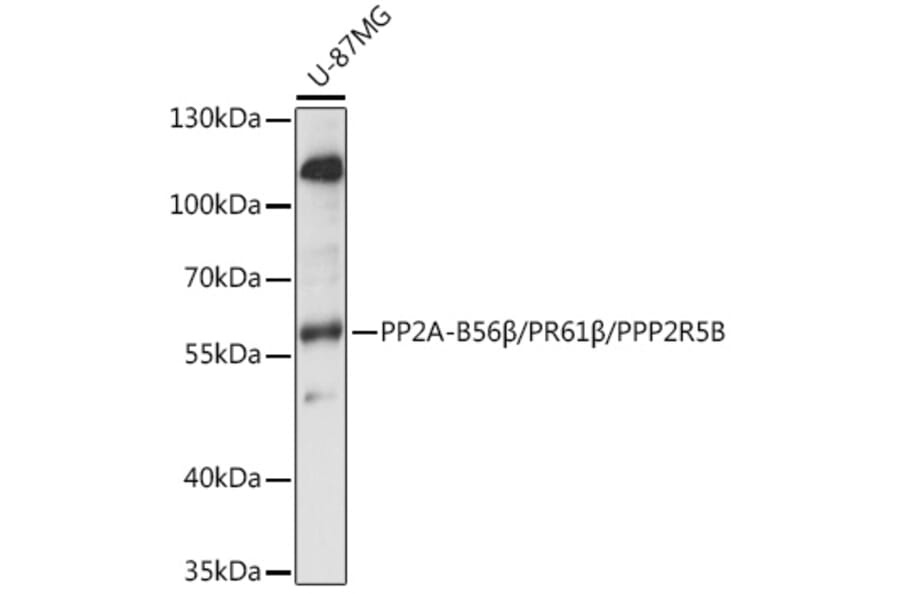 Western Blot - Anti-PPP2R5B Antibody (A90578) - Antibodies.com