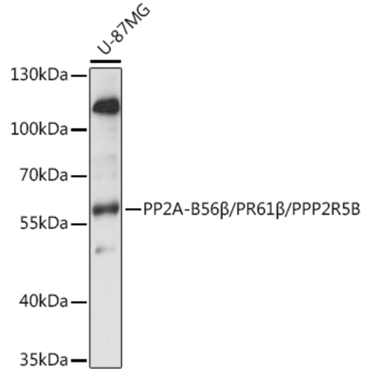 Western Blot - Anti-PPP2R5B Antibody (A90578) - Antibodies.com