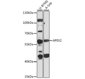 Western Blot - Anti-APEX2 Antibody (A90579) - Antibodies.com