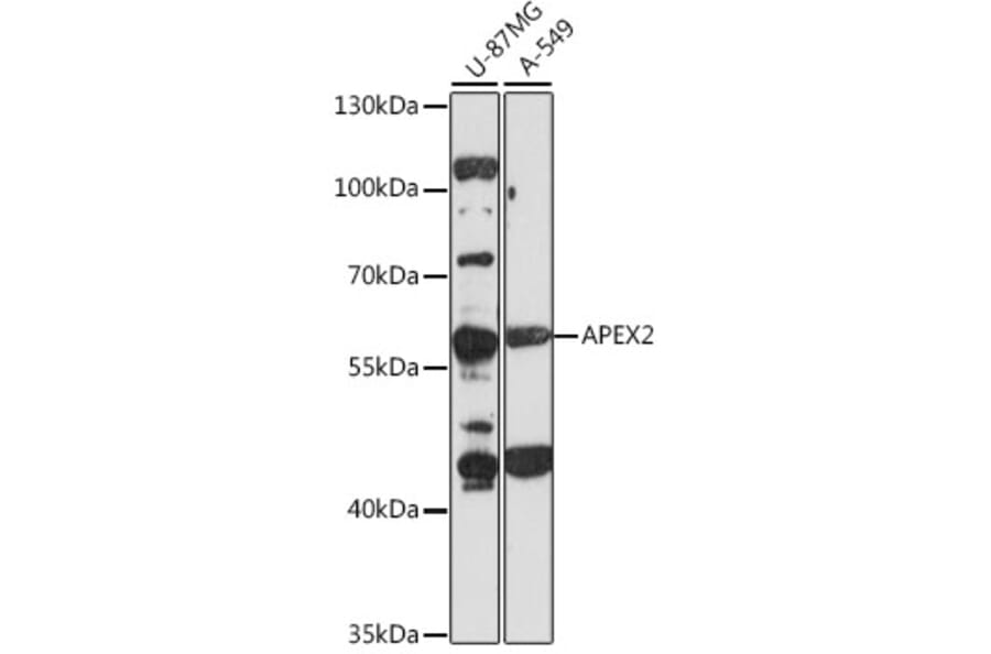 Western Blot - Anti-APEX2 Antibody (A90579) - Antibodies.com