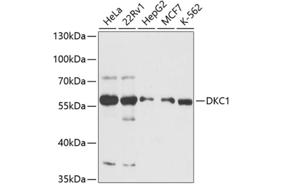 Western Blot - Anti-DKC1/Dyskerin Antibody (A90580) - Antibodies.com