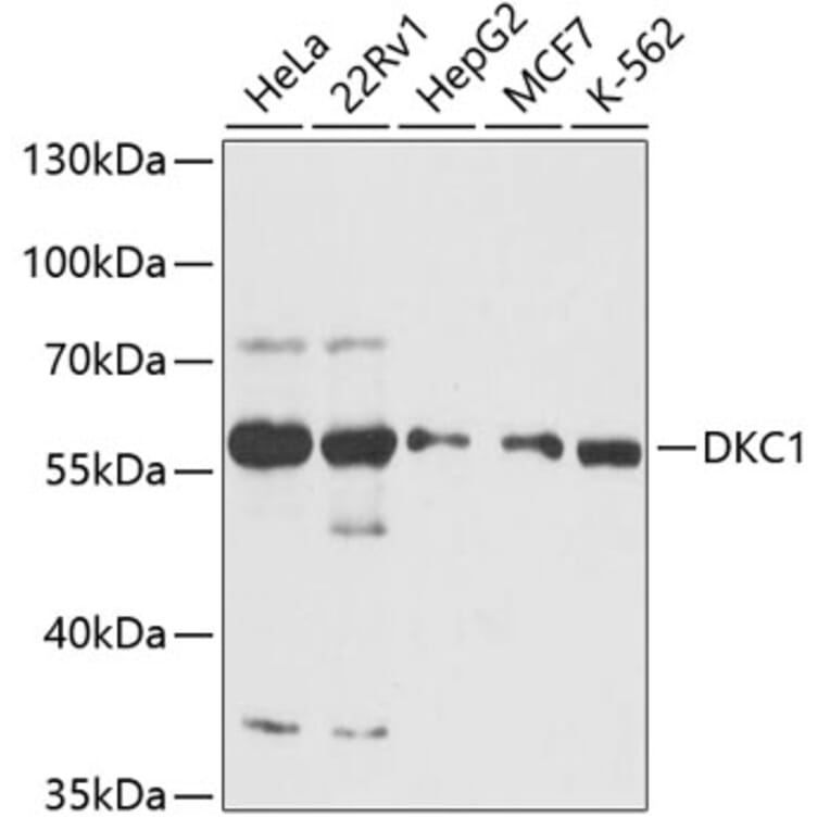 Western Blot - Anti-DKC1/Dyskerin Antibody (A90580) - Antibodies.com