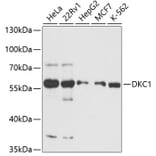 Western Blot - Anti-DKC1/Dyskerin Antibody (A90580) - Antibodies.com