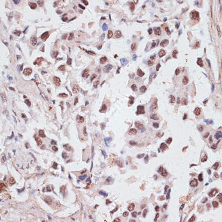 Immunohistochemistry - Anti-DKC1/Dyskerin Antibody (A90580) - Antibodies.com