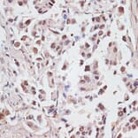 Immunohistochemistry - Anti-DKC1/Dyskerin Antibody (A90580) - Antibodies.com