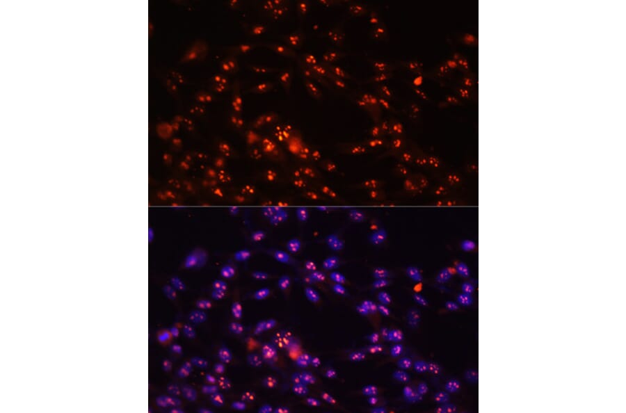 Immunofluorescence - Anti-DKC1/Dyskerin Antibody (A90580) - Antibodies.com