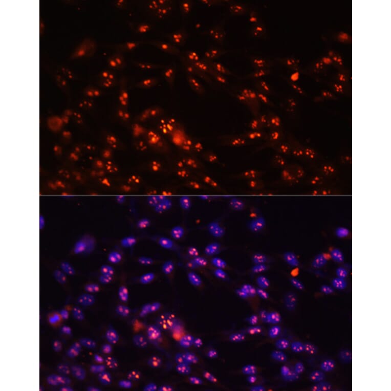 Immunofluorescence - Anti-DKC1/Dyskerin Antibody (A90580) - Antibodies.com