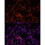 Immunofluorescence - Anti-DKC1/Dyskerin Antibody (A90580) - Antibodies.com