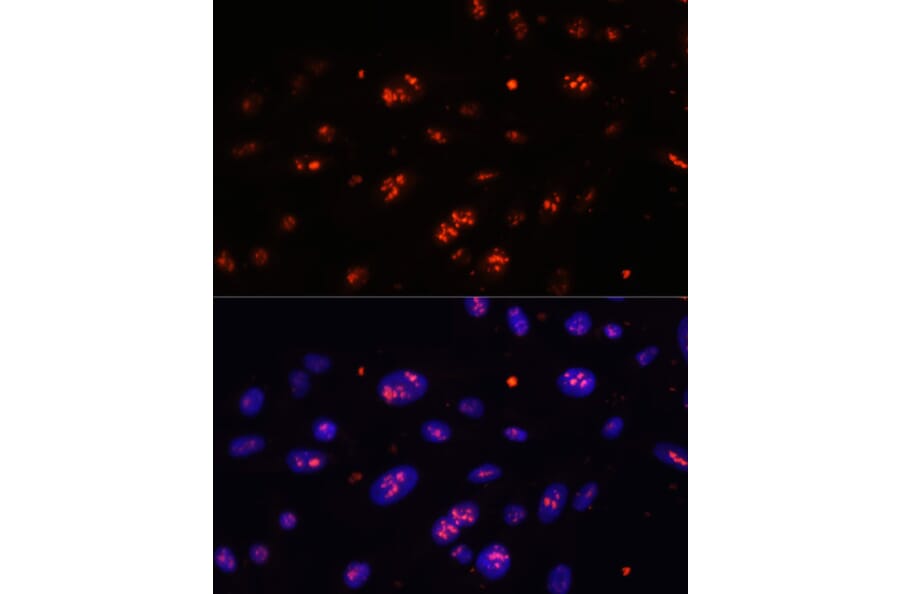 Immunofluorescence - Anti-DKC1/Dyskerin Antibody (A90580) - Antibodies.com