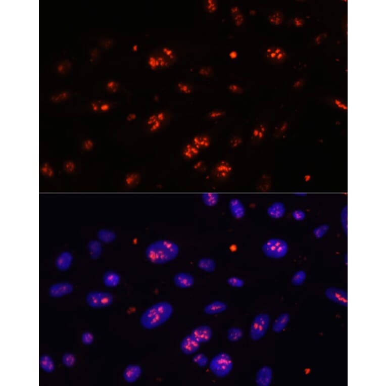 Immunofluorescence - Anti-DKC1/Dyskerin Antibody (A90580) - Antibodies.com