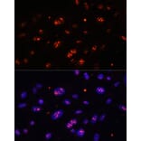 Immunofluorescence - Anti-DKC1/Dyskerin Antibody (A90580) - Antibodies.com