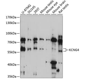 Western Blot - Anti-KCNG4 Antibody (A90581) - Antibodies.com