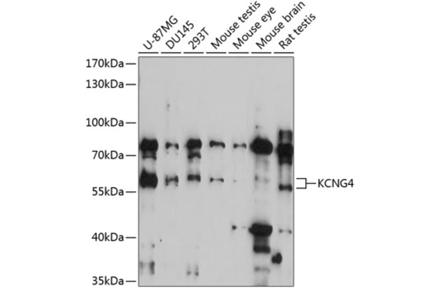 Western Blot - Anti-KCNG4 Antibody (A90581) - Antibodies.com