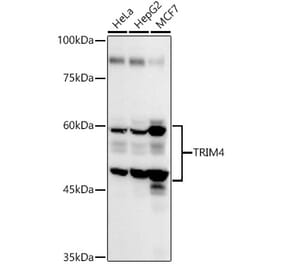 Western Blot - Anti-TRIM4 Antibody (A90582) - Antibodies.com
