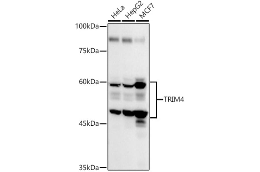 Western Blot - Anti-TRIM4 Antibody (A90582) - Antibodies.com