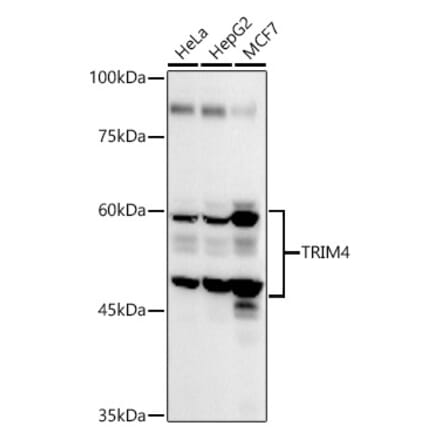 Western Blot - Anti-TRIM4 Antibody (A90582) - Antibodies.com