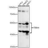 Western Blot - Anti-TRIM4 Antibody (A90582) - Antibodies.com