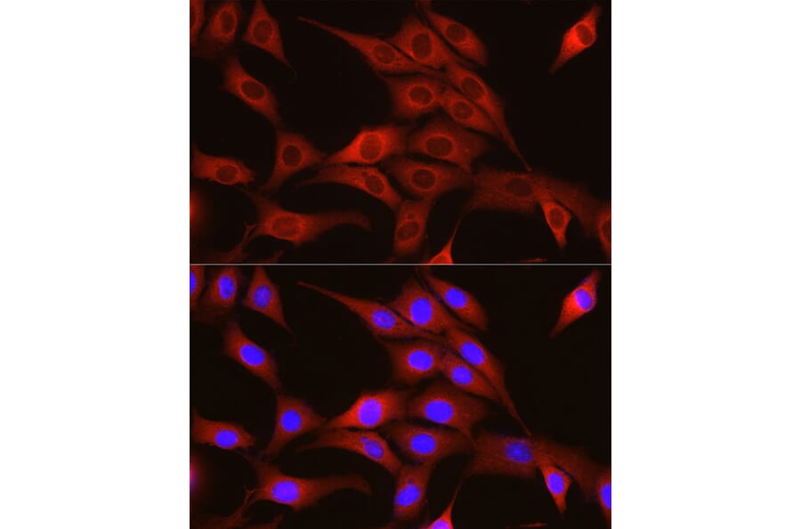Immunofluorescence - Anti-TRIM4 Antibody (A90582) - Antibodies.com